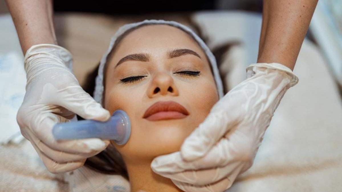What is Facial Cupping?
